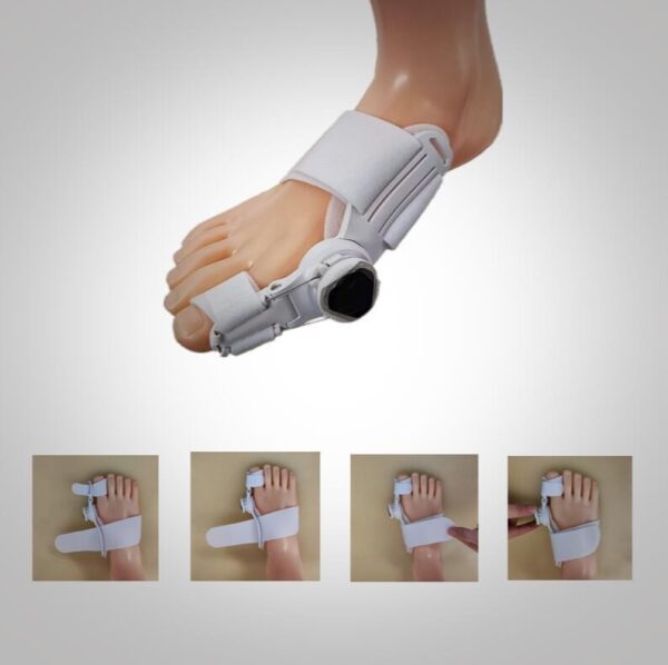 Mechanical Adjustable Hallux Valgus Day And Night Use - Image 4